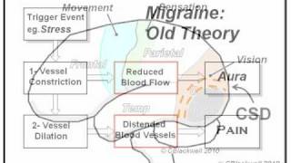 Migraine 1 The Experience [upl. by Ahsote]