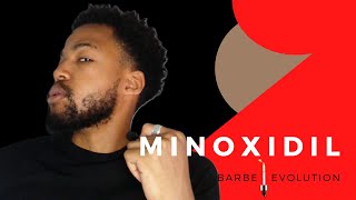 FAQ  Le MINOXIDIL en 8 Questions  minoxidil barbe barber [upl. by Anoblav]