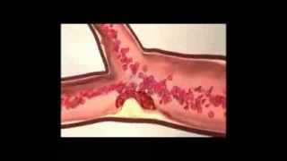 Trombus Formation and Fibrinolysis [upl. by Nobie391]