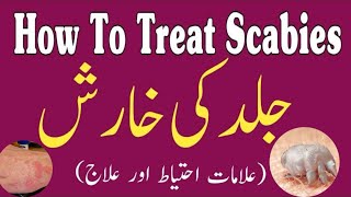 Scabies ka ilaj in Urdu  Scabies Ke wajuhat or Alamat Urdu  Kharish khatam karne ka Tarika  खुजली [upl. by Rodney]