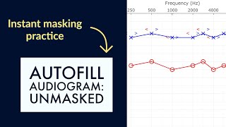 Instant masking practice with Theta Autofill your audiogram with unmasked thresholds [upl. by Bean10]