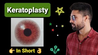 Keratoplasty lecture in opthalmology [upl. by Htidirrem738]