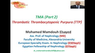 Thrombotic Thrombocytopenic Purpura TTP TMA part 2 [upl. by Guthrie314]