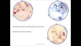 Enteromonas hominis [upl. by Eric]