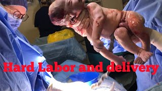 Difficult birth and unsettled baby laboranddelivery birth video [upl. by Irami646]