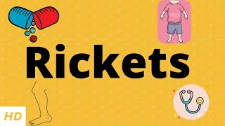 Rickets Causes Signs and Symptoms Diagnosis and Treatment [upl. by Aprilette454]