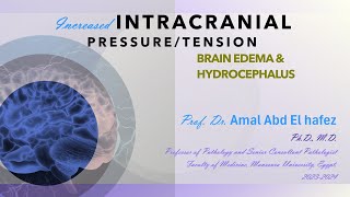 Increased ICP lecture hydrocephalus and edema 1CNS HUشرح محاضرة [upl. by Pritchett]