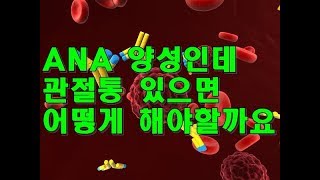 항핵항체 ANA 양성인데 관절통 있으면 어떻게 할까 Antinuclear antibody [upl. by Nadnerb]