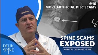 More Artificial Disc Scams on Facebook  Ep10 Spine Scams Exposed [upl. by Winograd]