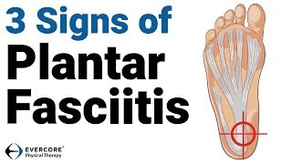 Plantar Fasciitis 3 signs you may have plantar fasciitis [upl. by Atnahsal]