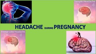 Headache in Pregnancy  TOG article [upl. by Catto]