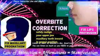 affirmations overbite correction get rid of lip protrusion maxillary prognathism correction [upl. by Arissa]