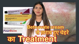 Betnovate c steroid creams side effects  लाल चेहरे का ट्रीटमेण्ट । [upl. by Phyllida961]