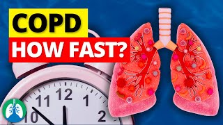 How Fast Does COPD Progress [upl. by Pia758]