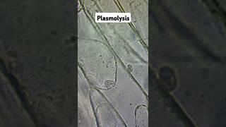 Plasmolysis and Osmosis biology gcse [upl. by Deth]