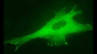 Actin Filament Induced Movement II Cell Adhesion [upl. by Haze]