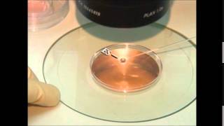 vitrification of embryos and oocytes [upl. by Balling495]