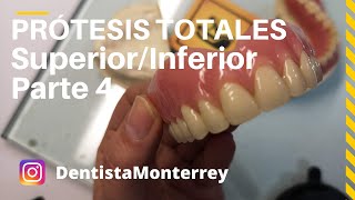 PASOS Prácticos PrótesisTotales👅Parte4 Prueba dientesAjustesPrótesisTerminada DentaduraCompleta [upl. by Aan]