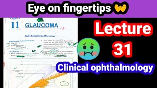 primary open angle glaucoma eye lectures 31 [upl. by Romeu]