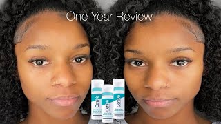 ✨Watch this before using CeraVe Resurfacing Retinol Serum  1 year review  Mini QampA  Does it work [upl. by Ap774]