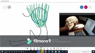 Mandibular movements and mandibular axes [upl. by Everest]