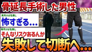 【2ch面白いスレ】【悲報】骨延長失敗した人、遂に切断へ [upl. by Hewes]