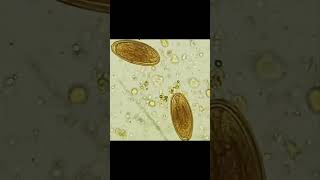 Parasitology  Identify [upl. by Nochur]