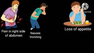 Appendicitis Definition Cause symptoms management [upl. by Jones91]