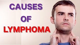 What Are Main Causes of Lymphoma Leukemia Symptoms Lymphoma Cancer Lymphatic System [upl. by Standish]