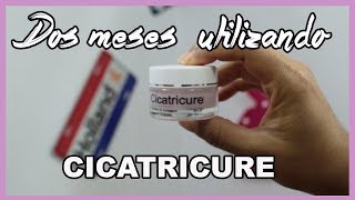 Crema Cicatricure contorno de ojos ¿Funciona de verdad [upl. by Etteloc]