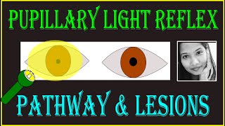 Pupillary Light Reflex – Pathway amp Lesions  Neuro ophthalmology [upl. by Paulette]