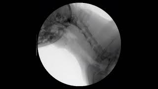 Canine mainstem bronchial and tracheal collapse fluoroscopy [upl. by Safoelc]