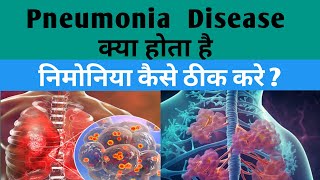 Pneumonia Symptoms And Treatments  निमोनिया को कैसे ठीक करे  Respiratory Infection Treatments [upl. by Orgel932]