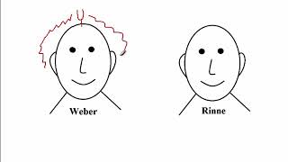 USMLE ACE Video 222 Types of Hearing Loss Conductive vs Sensorineural [upl. by Gabrielson]