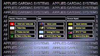 HolterMonitoringcom Holter Monitoring Software Analysis Demonstration [upl. by Cathy607]