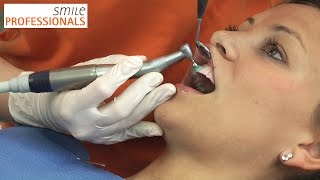 Professionelle Zahnreinigung  Zahnarzt Dr Seifert Aschaffenburg  Smile Professionals [upl. by Ayarahs651]