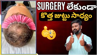 AskDrJohnWatts  SURGERY లేకుండా కొత్త జుట్టు సాధ్యం  Hair Specialist Explains [upl. by Ybrad]