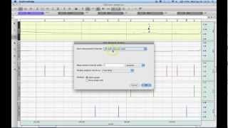 Stim Response Analysis [upl. by Bertine243]