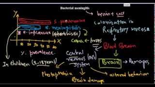 Bacterial meningitis [upl. by Ruomyes269]