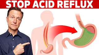 How to STOP Acid Reflux Instantly [upl. by Wildermuth]