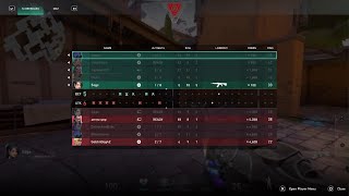 How I Hit RADIANT In CONSOLE VALORANT Using These SETTINGS [upl. by Maritsa876]