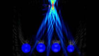 Electronically Scanned Ultrasound Phased Array [upl. by Teeter]