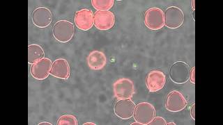 Babesia bovis merozoite egress from a red blood cell [upl. by Briny]