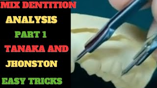 Tanaka And Jhonston AnalysisMixed Dentition AnalysisMixed dentition space analysis tanaka jhonsto [upl. by Yennek810]