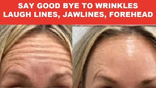 SKINCARE TIPS AntiAging Dark Circles Eye Bags Reduce Wrinkles Boost Collagen [upl. by Undine]