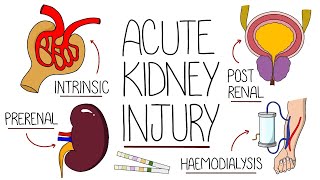 Acute kidney Injury [upl. by Enylodnewg474]