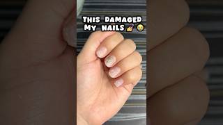 Nail extensions ki galti 😭😭nails nailsextension viralvideo shortsfeed viralshort trending [upl. by Seaden]