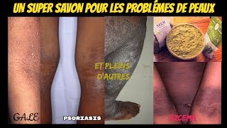 UN SUPER SAVON POUR LES PEAUX À PROBLÈMES eczéma  psoriasis gale et autres [upl. by Elstan176]