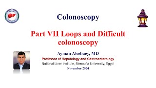 Colonoscopy Part VII Loops and difficult colonoscopy 2024 [upl. by Asereht]