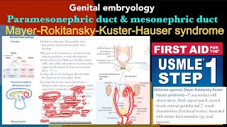 Genital embryology Male amp Female development ￼ Mullerian agenesis in HindiUrdu by USMLE step 1 [upl. by Riker]